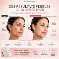 Masque Lumino-Thérapie  2.0™ -Peau Lisse & Éclatante - photo 3